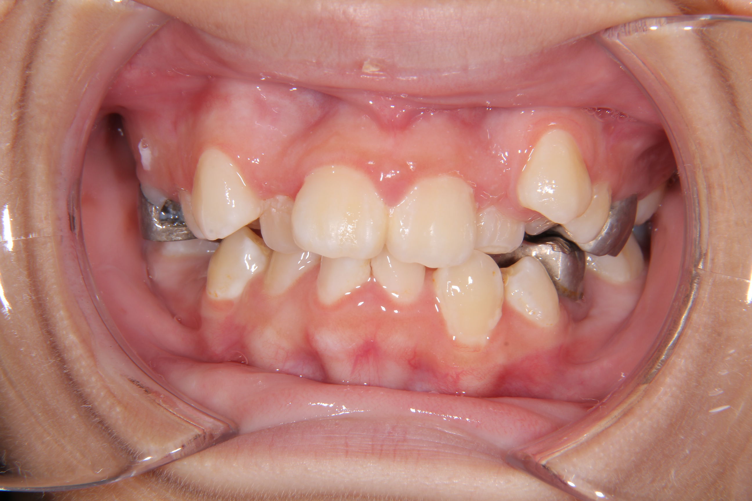 歯科矯正学 Root ZX mini | MORITA